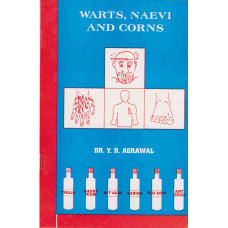 Warts, Naevi and Corns Warts, Naevi and Corns