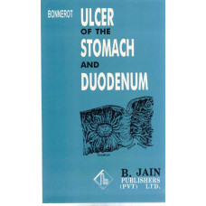 Ulcer of the Stomach and Duodenum